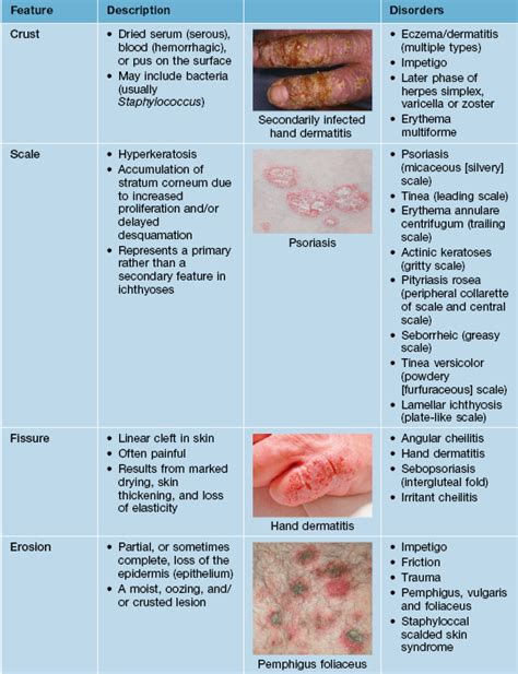 dermatology terms and abbreviations.